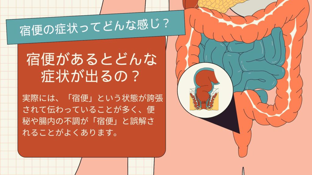 「宿便があると、どんな症状が出るの？」と疑問に思うかもしれません。実際には、「宿便」という状態が誇張されて伝わっていることが多く、便秘や腸内の不調が「宿便」と誤解されることがよくあります。